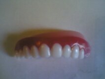 Жалоба-отзыв: Onlinereshenie.ask@bk.ru - Отсутствие зуба на винире.  Фото №1
