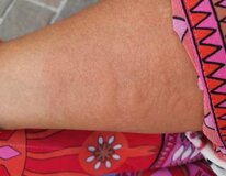 Жалоба-отзыв: Жасмин Байсен начищающий блогер из Падуа - Меня заразила венерической болезнью пожилая женщина легкого поведения.  Фото №1